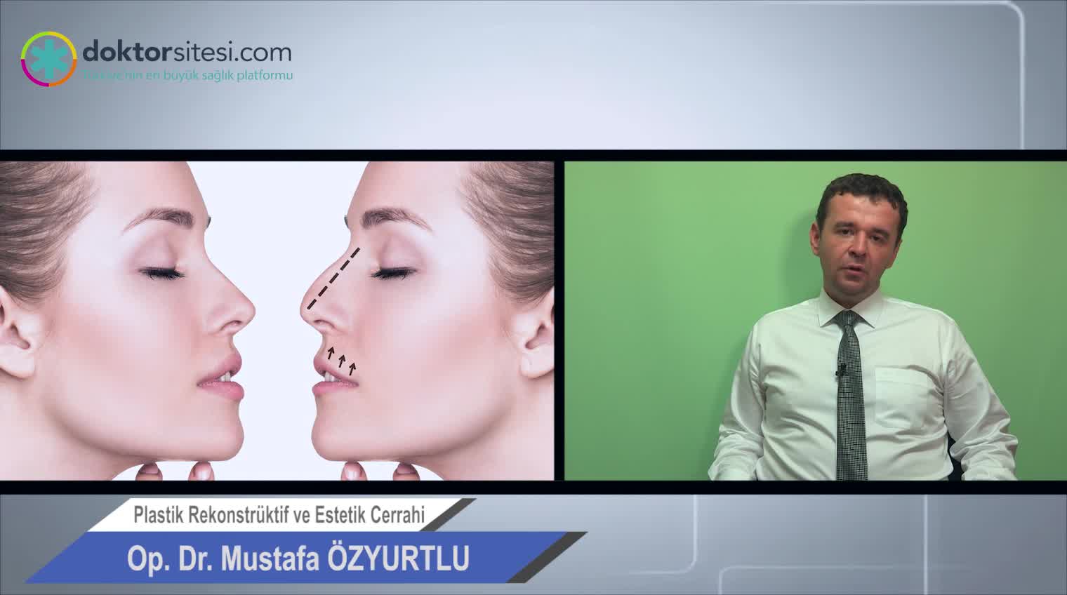 Burun estetiği sonrası düzeltme gereken hastalar yeniden ameliyat olabilir mi?