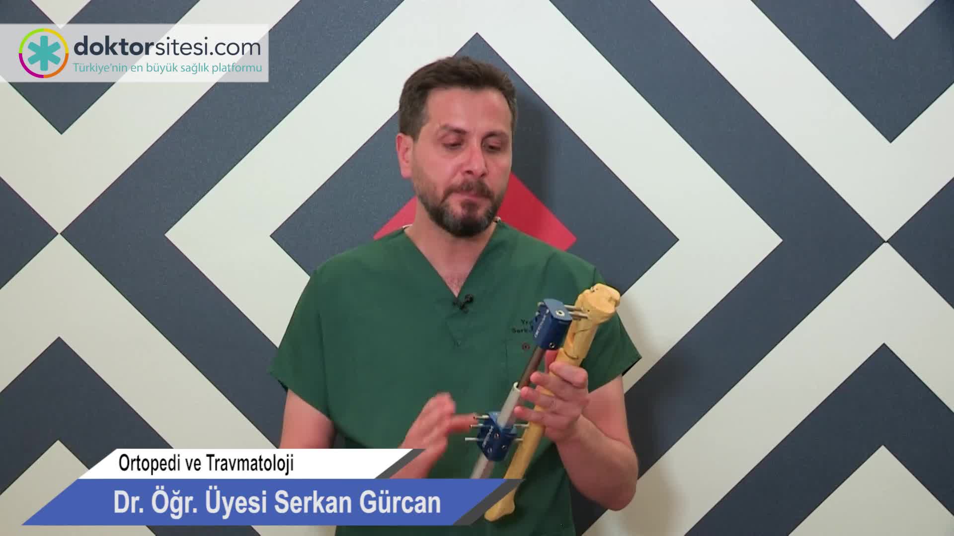Dışardan tek taraflı boy uzatma (Monolateral Eksternal Fiksatör)