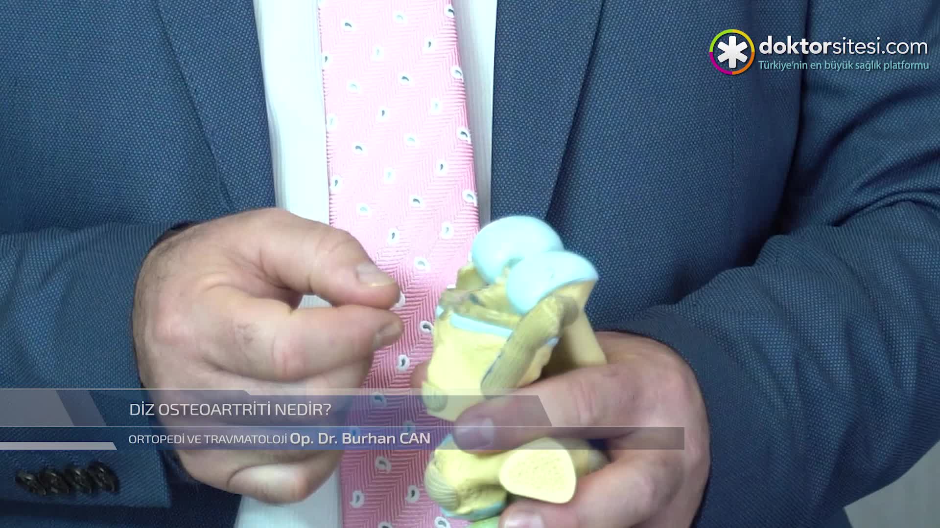 Diz Osteoartriti nedir?