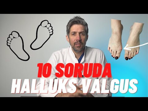 Halluks Valgus(Ayak Başparmak Eğriliği) /Ayağımda Kemik Çıkıntısı Var