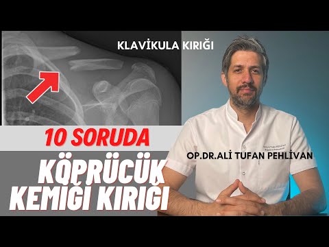 Köprücük Kemiği Kırığı (Klavikula Kırıkları)// Köprücük Kemiğin Kırığı Nasıl Tedavi Edilir?