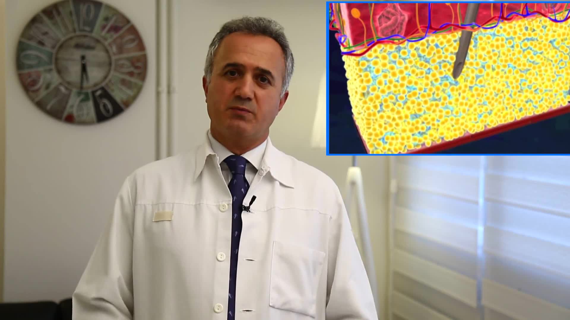 Liposuction Uygulamarı - Op. Dr. Sadullah Karun