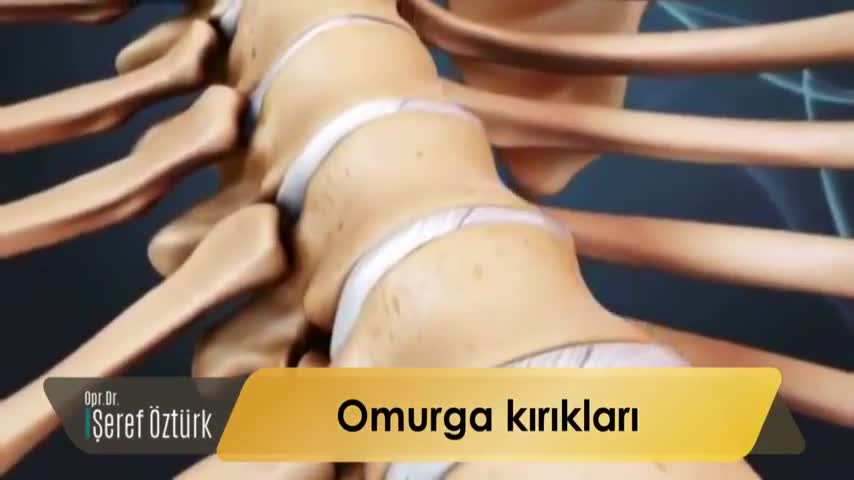 Omurga kırıkları