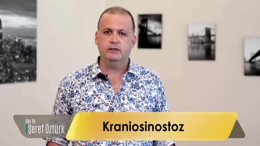 Kraniosinostoz
