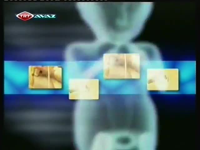TRT AVAZ - REÇETE