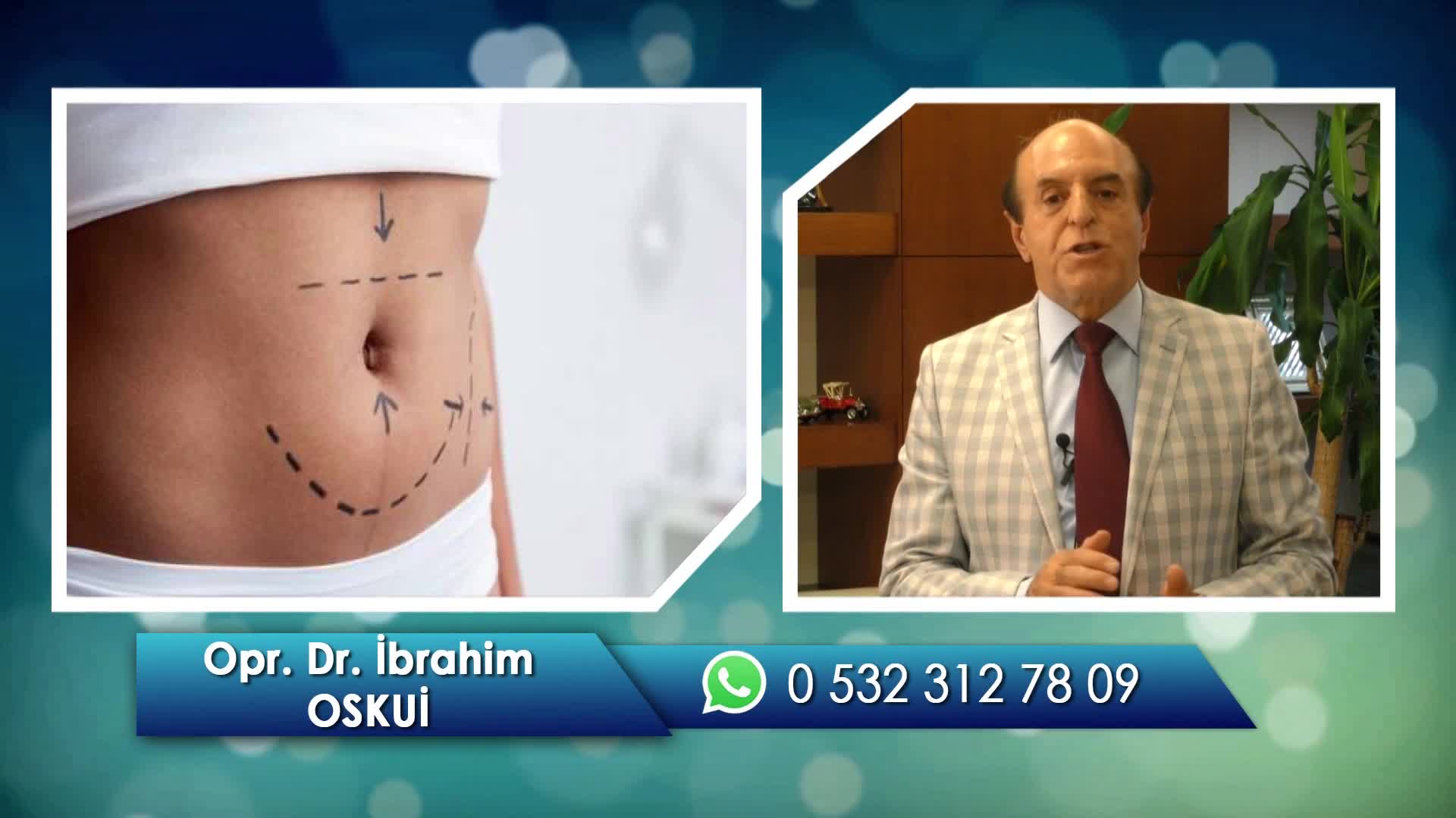 Youtube - Lipomatic Liposuction Yağ Alma Tedavisi