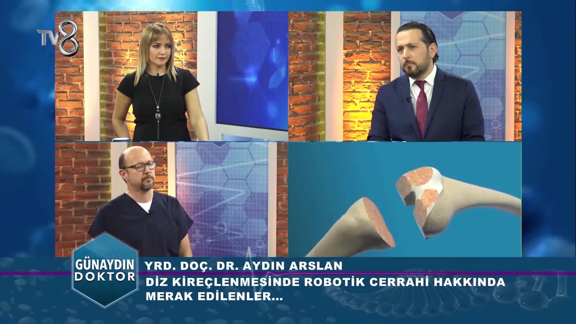 Youtube – Robotik diz protezi ameliyatı ile manuel arasındaki farklar