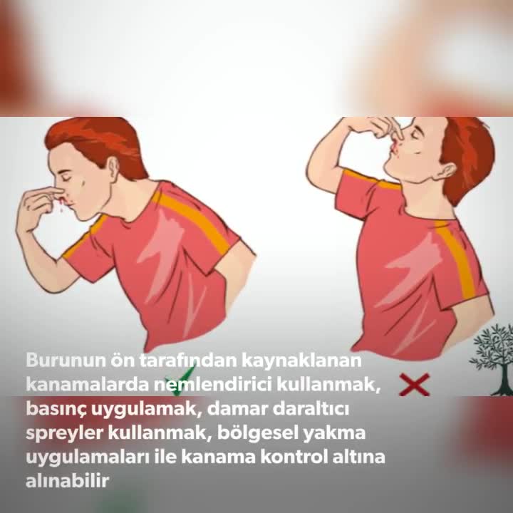 Youtube – Burun kanaması