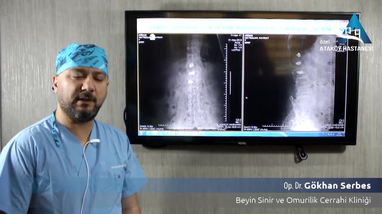 Youtube - Vertebroplast yani Omurga iltihabı!