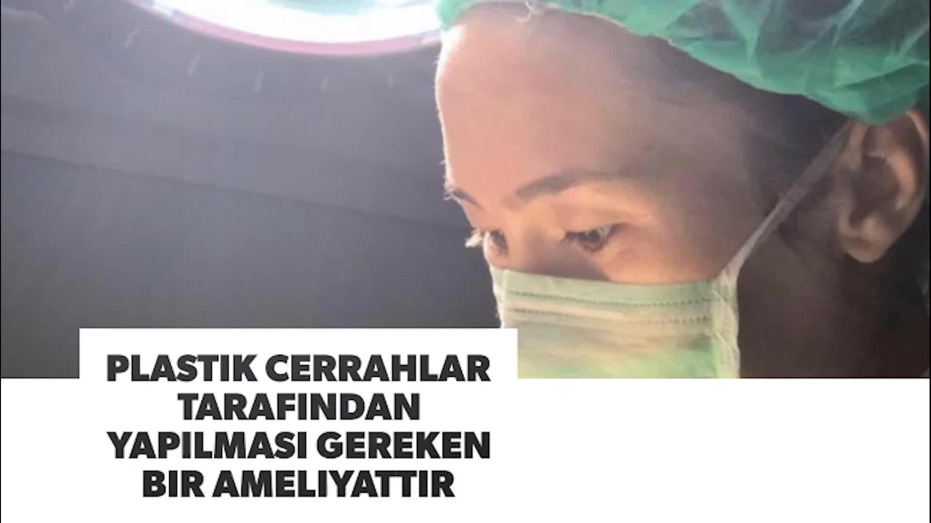 Youtube - Meme Küçültme Ameliyatı Hakkında Merak Edilenler