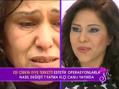 Youtube - Op.Dr İbrahim Oskui 'den Değişim Hikayesi..