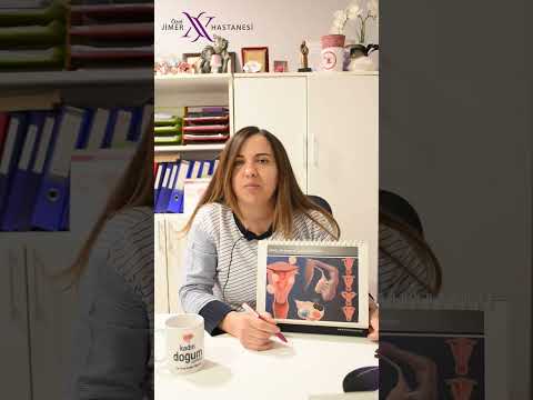 Myom Nasıl Tedavi Edilir?