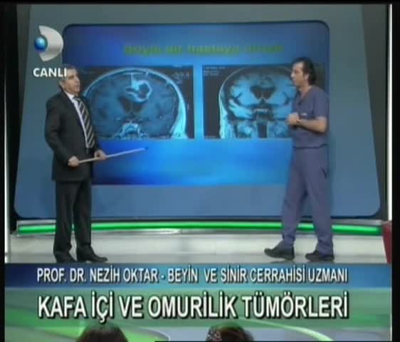 Youtube - Kafa içi ve Omurilik tümörleri