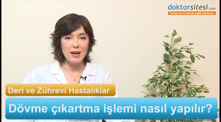 Dövme çıkartma (silme) işlemi nasıl yapılabilir?