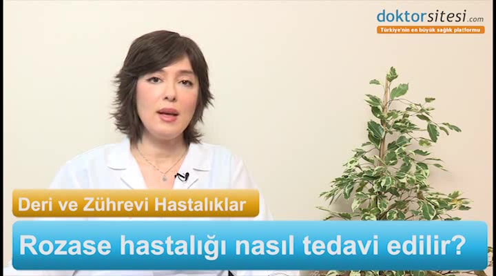 Rozase hastalığı nasıl tedavi edilir?