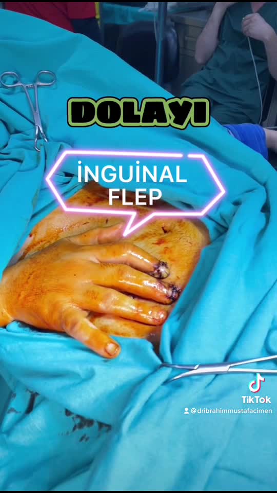 Youtube - İnguinal Flep