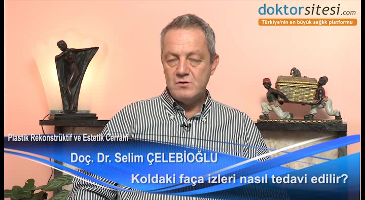 Koldaki faça izleri nasıl tedavi edilir?