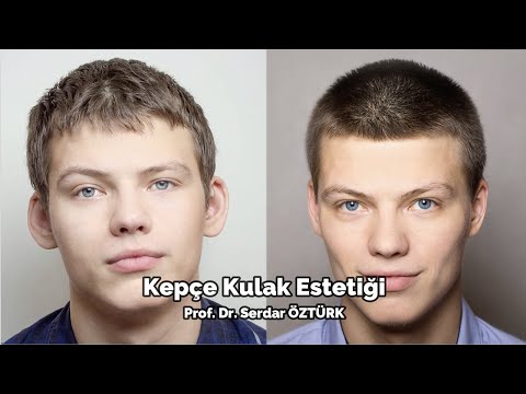 KEPCE KULAK AMELİYATI