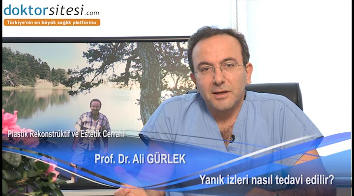 Yanık izleri nasıl tedavi edilir?