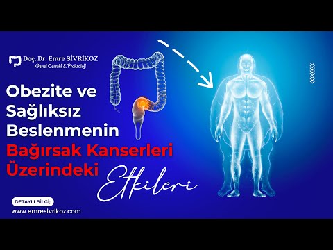 Obezite ve Sağlıksız Beslenmenin Bağırsak Kanserleri Üzerindeki Etkileri