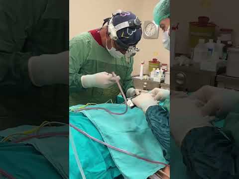 Before & After Rhinoplasty