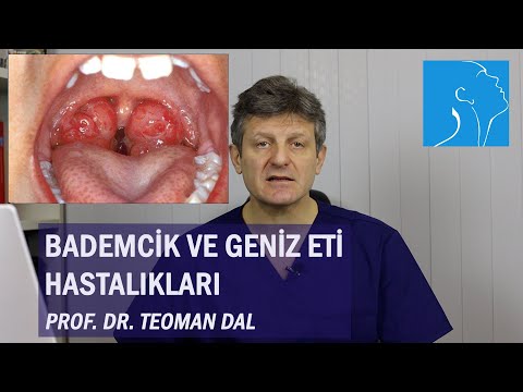 BADEMCİK VE GENİZ ETİ HASTALIKLARI | PROF. DR. TEOMAN DAL