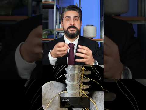 Boyun Fıtığı Nedir? Ne Zaman Doktora Gitmek Gerekir?