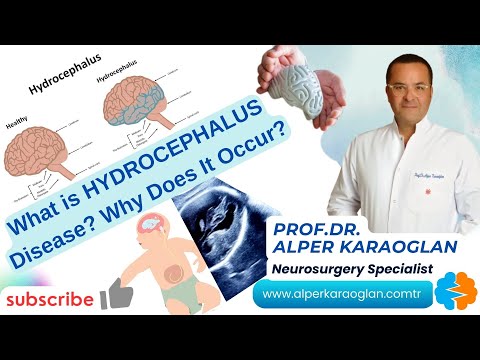 What is HYDROCEPHALUS Disease? Why Does It Occur? | Prof Dr Alper KARAOGLAN