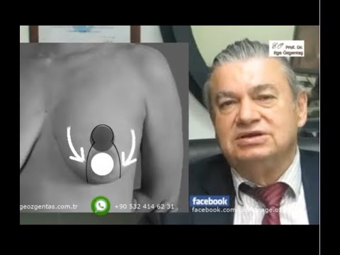 Meme Dikleştirme Ameliyatı - Sarkık Meme Problemi