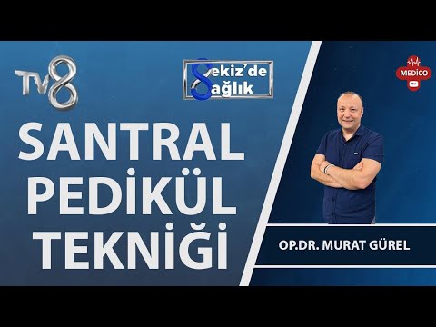 Santral Pedikül Nedir? | Op. Dr. Murat Gürel | 8'de Sağlık