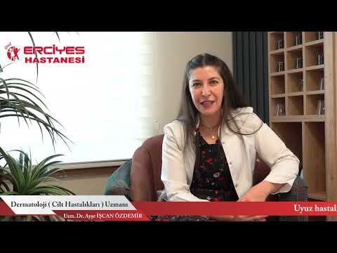 UYUZ HASTALIĞI - UZM. DR. AYŞE ÖZDEMİR