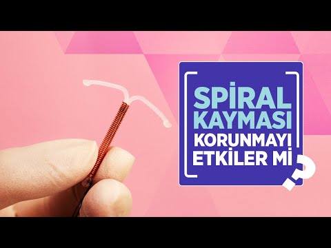 Spiral Kayması Neden Olur? Belirtileri Nelerdir? Rahim İçi Spiral Kayması Nasıl Düzeltilir?