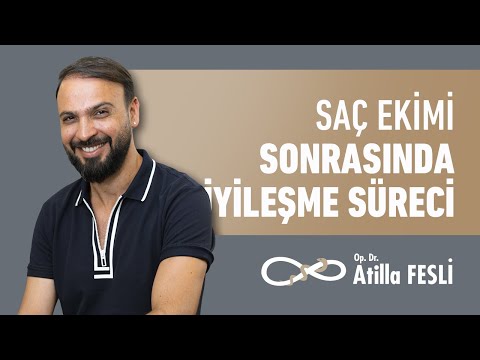 Saç Ekimi Sonrasında İyileşme Süreci Nasıl Oluyor?