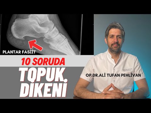 Topuk Dikeni //Sabah Topuk Ağrısı//Topuğuma Basamıyorum// Plantar Fasiit