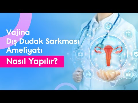 Vajina Dış Dudak Sarkması Neden Olur? Nasıl Düzeltilir? Ameliyat Sonrası Dikkat Edilmesi Gerekenler