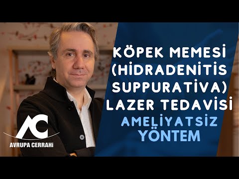 Köpek Memesi (Hidradenitis Suppurativa) Lazer Tedavisi - Avrupa Cerrahi