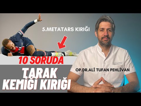 Tarak Kemiği (5. Metatars) Kırıkları Nedir? // Tarak Kemiği Kırığı Tedavisi Nasıl Yapılır?