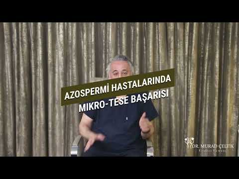 Azospermi Hastalarında Mikro-tese Başarısı I Op. Dr. Murad Çeltik
