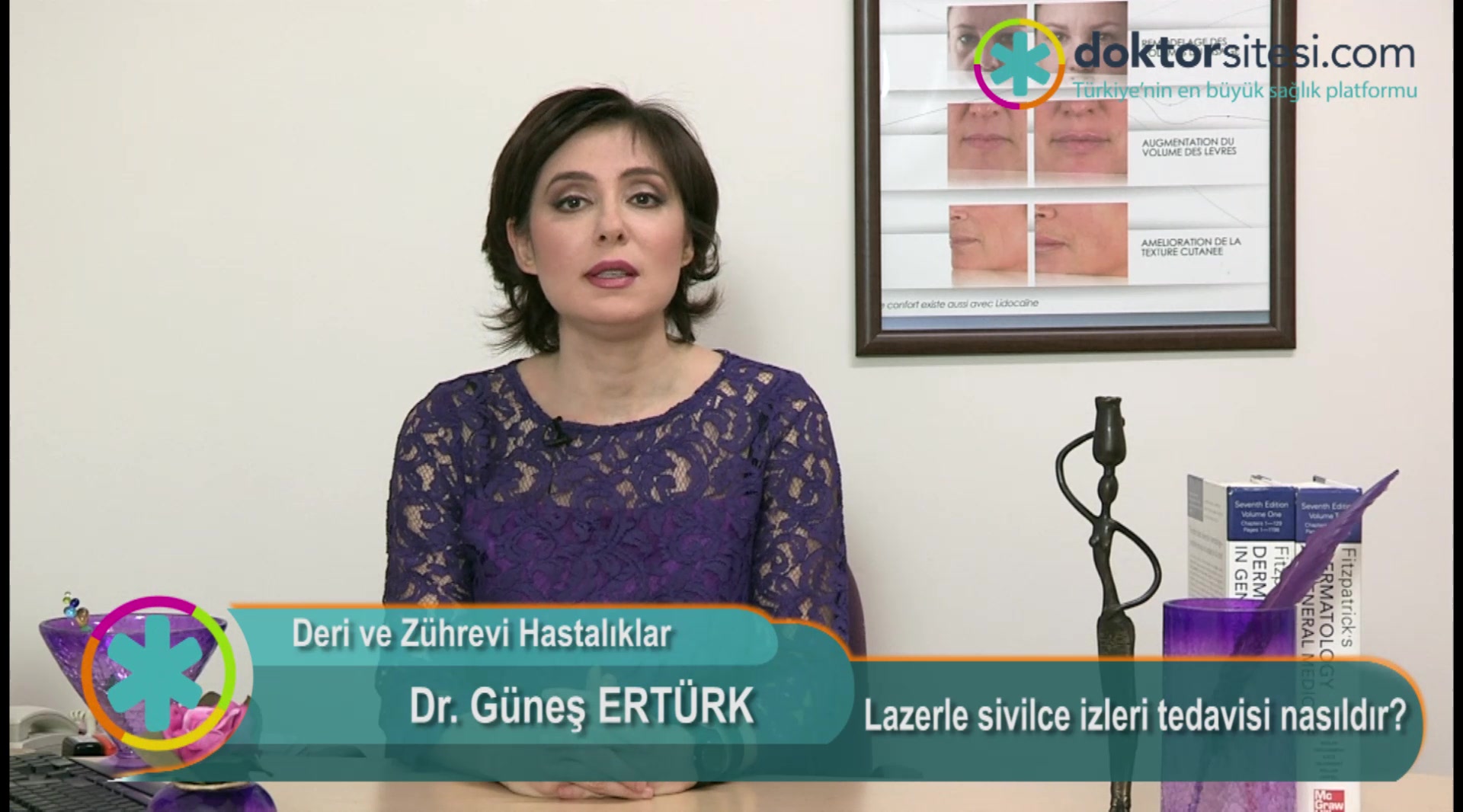 Lazerle sivilce izleri tedavisi nasıldır?