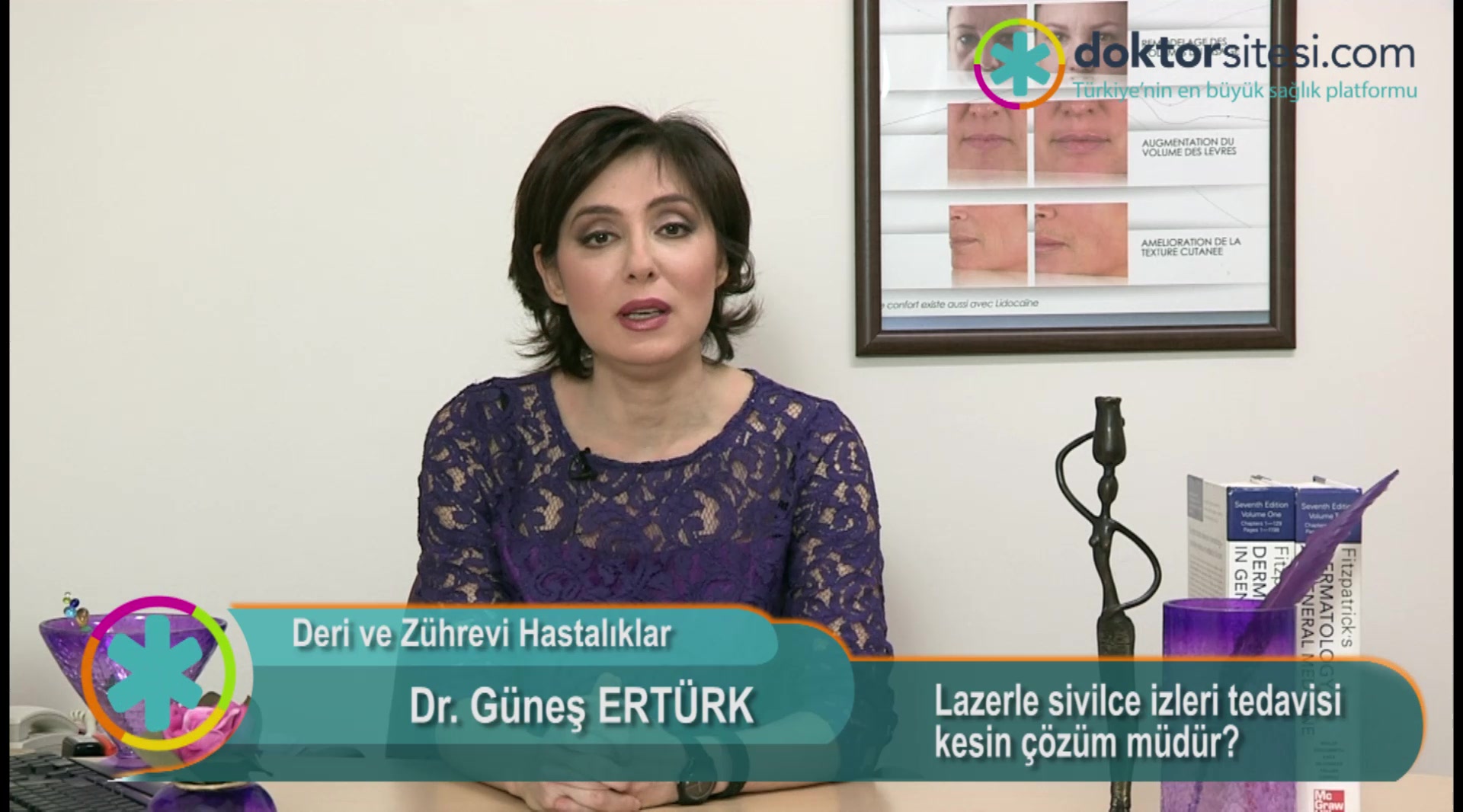 Lazerle sivilce izleri tedavisi kesin çözüm müdür?