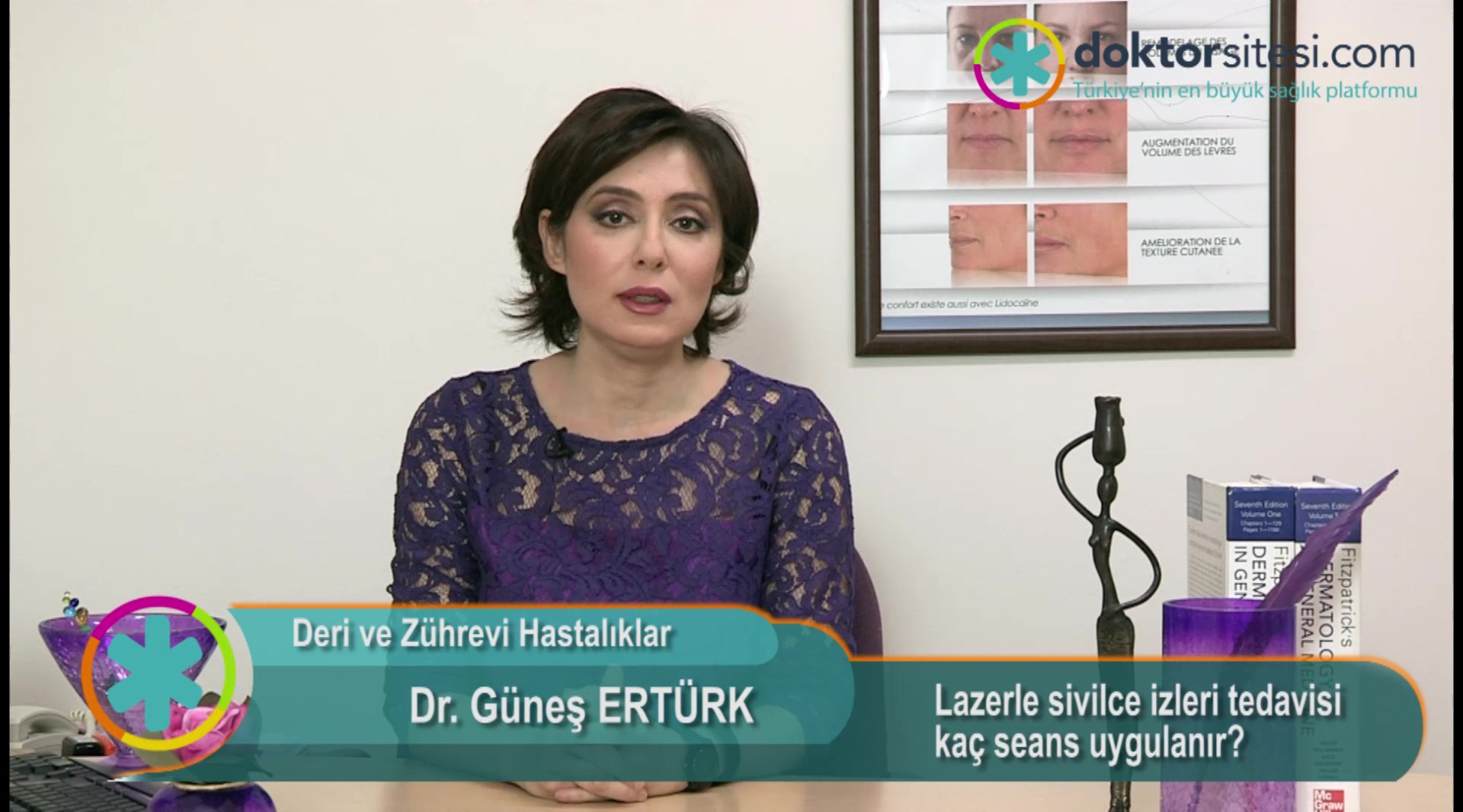 Lazerle sivilce izleri tedavisi kaç seans uygulanır?