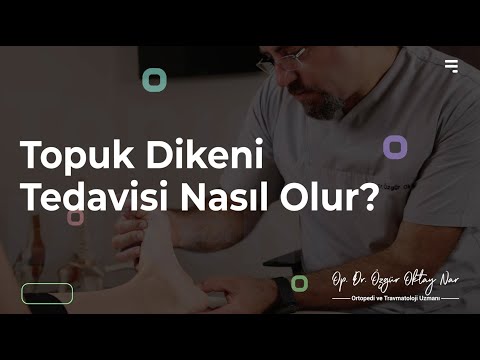 Topuk Dikeni Tedavisi Nasıl Olur?