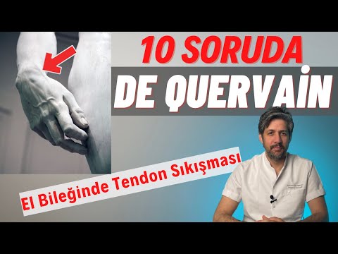 De Quervain Hastalığı (El Bileğinde Tendon Sıkışması) / El Bileğim Ağrıyor