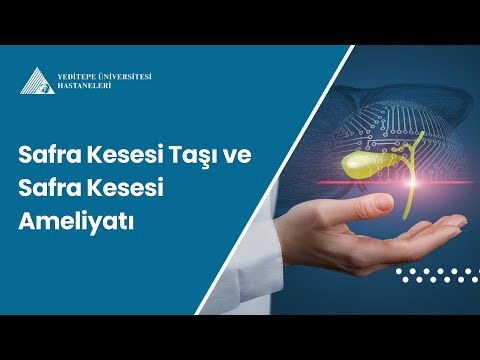 Safra Kesesi Taşı ve Safra Kesesi Ameliyatı / Doç. Dr. Veysel Umman