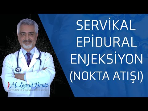 Op. Dr. M. Levent Deniz | Nokta Atışı (Servikal Epidural Enjeksiyon Tedavisi)