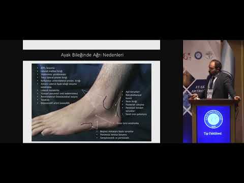 01. Ayak Bileği Artroskopisinde Endikasyonlar - Dr. Abdurrahman Vural