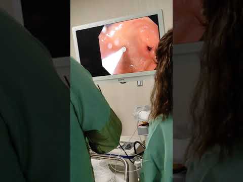 Mide botoksu uygulaması. Op.Dr. Gökhan Göziş