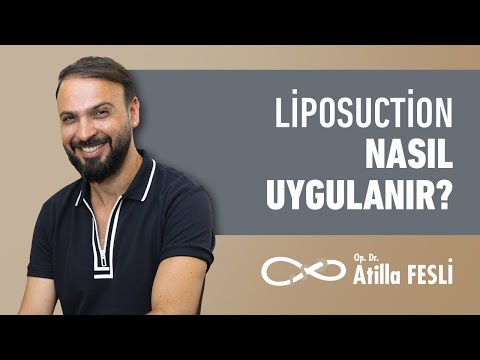 Liposuction Nasıl Uygulanır?
