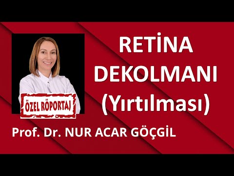 RETİNA DEKOLMANI / Prof. Dr. Nur Acar GÖÇGİL