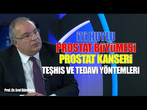 Prof. Dr. Erol Güntekin | İyi Huylu Prostat Büyümesi Nedir? Prostat Kanseri Teşhis ve Tedavisi